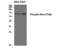 Western Blot (WB) analysis of HeLa COLO205 using Phospho-Ezrin (T566) antibody