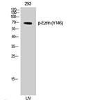 Western Blot (WB) analysis of 293 cells using Phospho-Ezrin (Y146) Polyclonal Antibody.