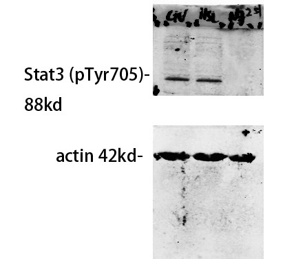 Western Blot analysis of our customer's samples using primary antibody diluted at 1:500, The picture was kindly provided by our customer.