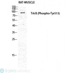 Western Blot (WB) analysis of Rat Muscle cells using Phospho-Trk B (Y516) Polyclonal Antibody.