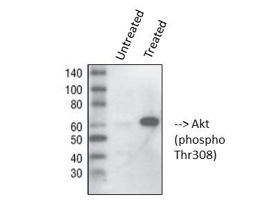 Western blot (WB) analysis of AKT (phospho Thr308) polyclonal antibody.