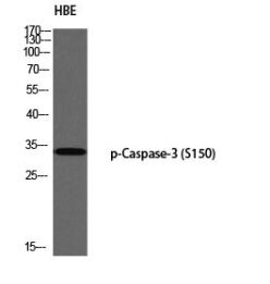Western Blot (WB) analysis of HBE using p-Caspase-3 (S150) antibody