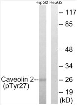 Western Blot Image using ABP10182  Phospho-Caveolin-2 (Y27) antibody