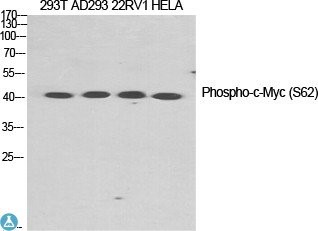 Western Blot (WB) analysis of 293T, AD293, 22RV1 and HeLa cells, using Anti-Phospho-c-Myc (S62) polyclonal antibody.