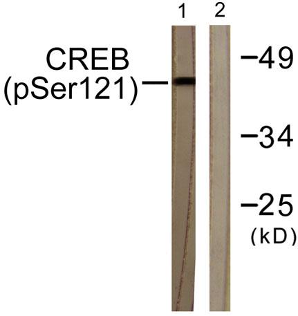 Western blot analysis of lysates from HeLa cells treated with Etoposide 25uM 24h, using CREB (Phospho-Ser121) Antibody. The lane on the right is blocked with the
phospho peptide.