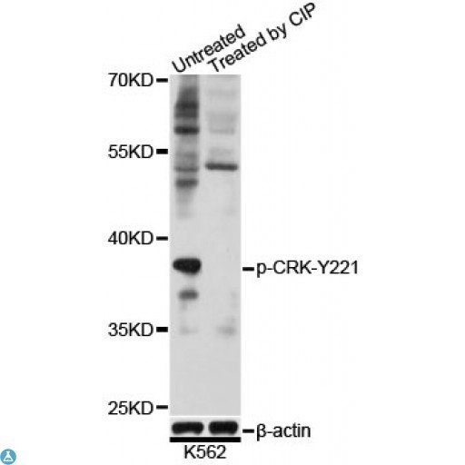 Western blot analysis of extracts of K562 cells, using Phospho-CRK-Y221 antibody at 1:1000 dilution. K562 cell lysate were treated by CIP (20ul CIP for each 400ul cell lysate) at 37℃ for 1 hour . Secondary antibody: HRP Goat Anti- Rabbit IgG (H+L) at 1:10000 dilution. Lysates/proteins: 25ug per lane. Blocking buffer: 3% BSA. Detection: ECL West Pico Plus.   Exposure time: 10s.
