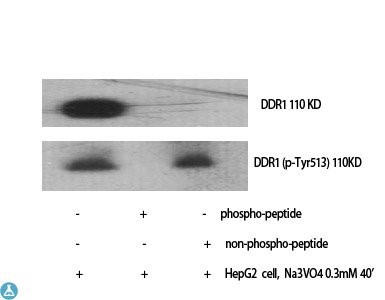 Western Blot (WB) analysis of specific cells using Phospho-DDR1 (Y513) polyclonal antibody.
