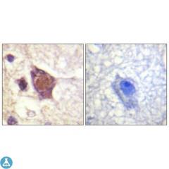 Immunohistochemical analysis of paraffin-embedded Human brain. Antibody was diluted at 1:100 (4°C, overnight). High-pressure and temperature Tris-EDTA, pH8.0 was used for antibody retrieval. Negative control (right) obtained from antibody was pre-absorbed by immunogen peptide.