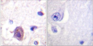 Immunohistochemistry - paraffin-embedded human brain. The picture on the right is blocked with the phospho peptide.
