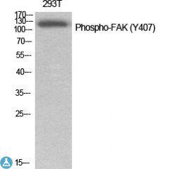 Western Blot (WB) analysis of specific cells using Phospho-FAK (Y407) polyclonal antibody.