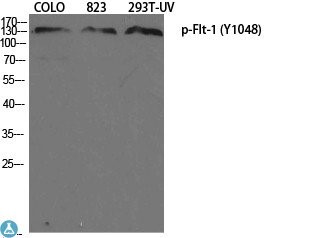 vWestern Blot (WB) analysis of COLO, 823 and 293-UV cells, using Anti-Phospho-Flt-1 (Y1048) polyclonal antibody.