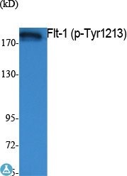 Western Blot (WB) analysis of extracts  from K562 cells, using Phospho-Flt-1 (Y1213) polyclonal antibody.
