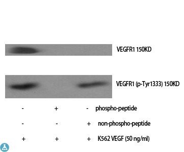 Western Blot (WB) analysis of  specific cells using Phospho-Flt-1  (Y1333) polyclonal antibody.