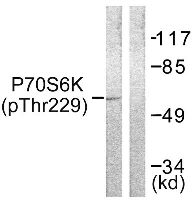 Western blot analysis of lysates from Jurkat cells, using p70 S6 Kinase (Phospho-Thr229) Antibody. The lane on the right is blocked with the phospho peptide.