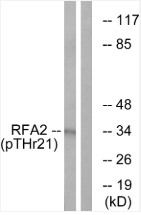 Western Blot Analysis using Phospho RPA32 (T21) antibody
