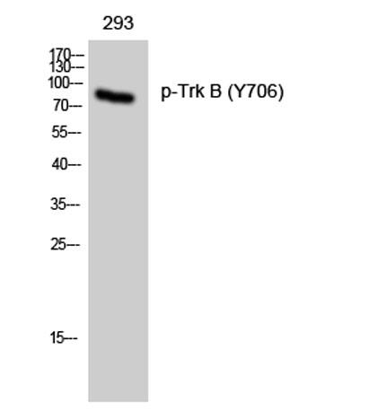 Western Blot analysis of 293 cells using Phospho-Trk B (Y706) Polyclonal Antibody diluted at 1:1000