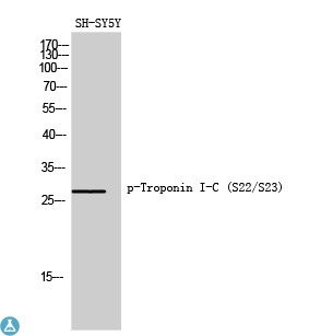 Western Blot (WB) analysis of SH-SY5Y cells using Phospho-Troponin I-C (S22/S23) polyclonal antibody.
