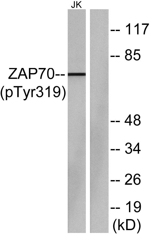 Western blot analysis of lysates from Jurkat cells, using ZAP-70 (Phospho-Tyr319) Antibody. The lane on the right is blocked with the phospho peptide.