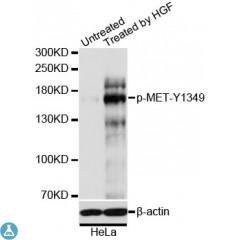 Western blot analysis of extracts of HeLa cells, using Phospho-MET-Y1349 antibody at 1:1000 dilution. HeLa cells were treated by HGF (40ng/ml) for 10 minutes after serum-starvation overnight. Secondary antibody: HRP Goat Anti-Rabbit IgG (H+L) at 1:10000 dilution. Lysates/proteins: 25ug per lane. Blocking buffer: 3% BSA. Detection: ECL Basic Kit. Exposure time: 90s.