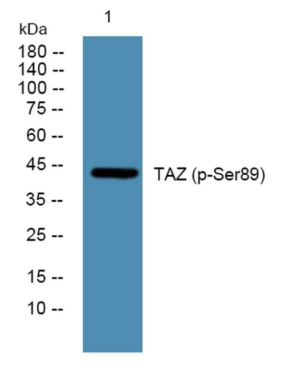 Western blot analysis of lysates from U2OS cells, primary antibody was diluted at 1:1000, 4°C over night