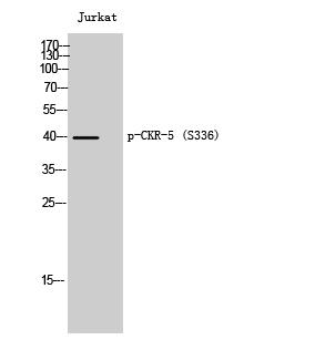 Western blotting validation for Anti-Phospho- CKR-5 (S336) CCR5 Antibody   Western Blot (WB) analysis of Jurkat cells using Phospho- CKR-5 (S336) polyclonal antibody.  Electrophoresis was performed on a SDS-PAGE gel. To determine SDS-PAGE gel concentration