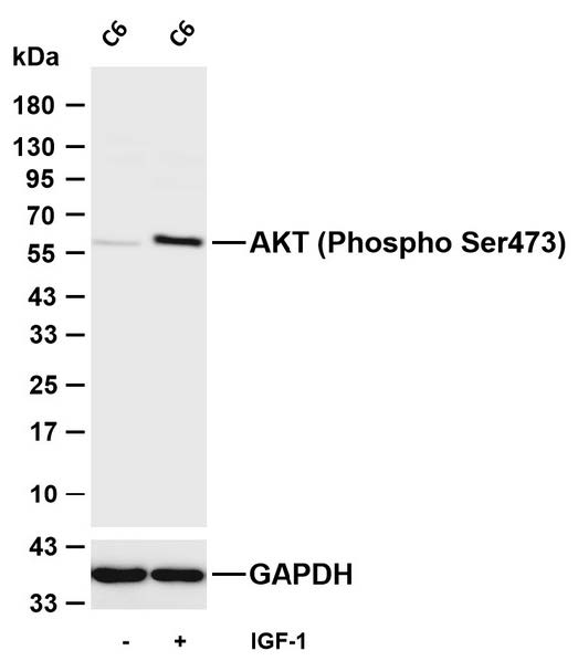 Various whole cell lysates were separated by 4-20% SDS-PAGE, and the membrane was blotted with anti-AKT (Phospho Ser473) antibody. The HRP-conjugated Goat anti-Rabbit IgG (H + L) antibody was used to detect the antibody.Lane 1: C6Lane 2: C6 was treated with IGF-1(50ng/mL) for 5 minutes-Observed band size: 60kDa