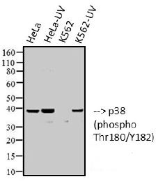 Western blot analysis of extracts from Hela (+UV) , Hela (-UV), K562 (+UV) , K562 (-UV) cells using Phospho-p38 MAPK (Thr180/Tyr182) antibody.