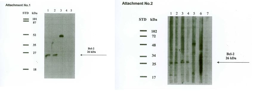 Immunohistochemistry staining of human placenta (paraffin-embedded sections) with anti-BCL2 (Bcl-2/100), 10 μg/ml.
