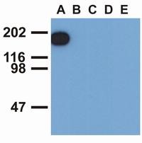 Western blotting analysis of EGFR (phospho-Tyr1173) by mouse monoclonal antibody EM-13 in EGF-treated A431 (A), CALU-3 (B), MCF-7 (C), Jurkat (D) and Ramos (E) cell lines (reducing conditions).