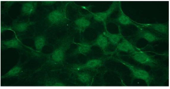 Representative pictures of Akt1 (only when phosphorylated at the Ser - 473 residue) in HEK293 cells, visualized with monoclonal rabbit anti -Akt1, pSer -473 monospecific antibody. Primary antibody dilution- 1:100.