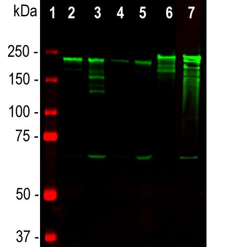 Western blot analysis of tissue lysates using mouse mAb to NF-H,
SMI-31, dilution 1:10,000 in green: protein standard (red),
rat brainrat spinal cord, mouse brain, mouse spinal cord,
pig spinal cordcow spinal cord. Strong band at about 200-220
kDa corresponds to the major phosphorylated from of the NF-H
subunit. A minor band at about 160 kDa is the non-phosphorylated
NF-H. Smaller proteolytic fragments of NF-H are also detected in
spinal cord preparations with SMI-31 antibody.