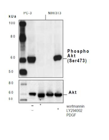 Western blot analysis of extracts from PC-3 cells, untreated or LY294002/wortmannin-treated, and NIH/3T3 cells, serumstarved or PDGF-treated, using Phospho-Akt (Ser473) (D9E) Rabbit mAb (upper) or Akt (pan) (C67E7) Rabbit mAb (lower).