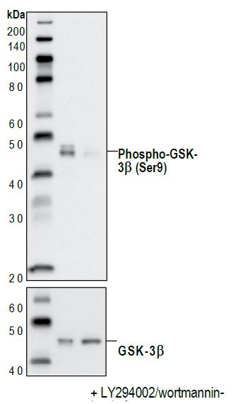 Western blot analysis of extracts from PC-3 cells, untreated or LY294002/wortmannin-treated, using Phospho-GSK-3beta (Ser9) (Rabbit mAb (upper) or GSK-3beta Rabbit (lower).