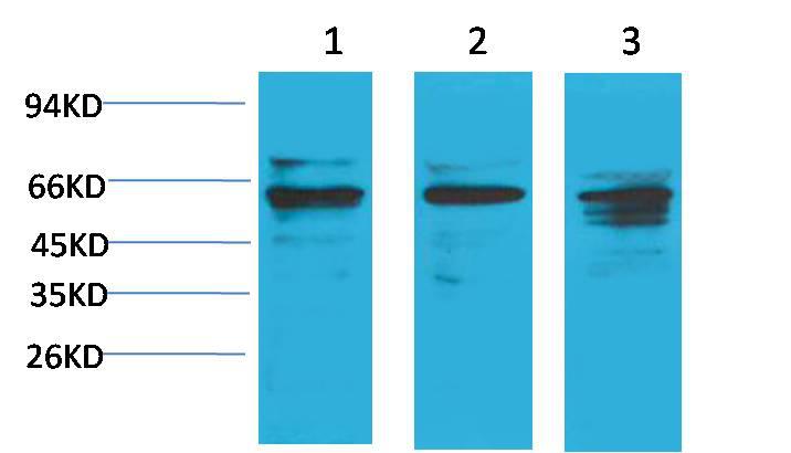 Western blot analysis of
1) Hela,
2)3T3,
3) PC12 with Akt1 Rabbit pAb diluted at 1:2,000.
