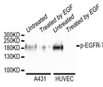 Western blot analysis of extracts of various cell lines, using Phospho-EGFR (Tyr669) monoclonal antibody.