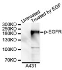 Western blot analysis of extracts of A431 cell line, using Phospho-EGFR (Tyr845) antibody.