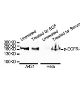 Phospho-EGFR (Tyr1068) Western blot analysis of extracts of various cell lines extracts of A431 and HeLa cells, using Phospho-EGFR-Tyr-1068 antibody at 1:1000 dilution. A431 cells were treated by EGF (100ng/ml) for 30 minutes after serum-starvation overnight. HeLa cells were treated by 10% FBS after serum-starvation overnight. Secondary antibody: HRP Goat Anti-Rabbit IgG (H+L) at 1:10,000dilution. Lysates/proteins: 25ug per lane Blocking buffer: 3% BSA. Detection: ECLPico Kit Exposure time: 1min.