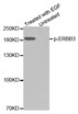 Western blot analysis of extracts from A431 cells using Phospho-ErbB3 (Tyr1328) Monoclonal Antibody