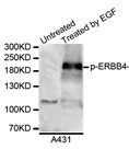Western blot analysis of extracts from A431 cells using Phospho-ErbB4 (Tyr1284)  Monoclonal Antibody