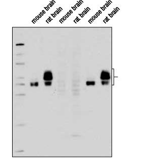 Western blot analysis of extracts from mouse and rat brain using Phospho-Tau (Thr181) (D9F4G) Rabbit mAb. The phospho¬specificity of Phospho-Tau (Thr181) (D9F4G) Rabbit mAb was verified by peptide blocking using a phosphopeptide or non-phosphopeptide targeting residue Thr181.