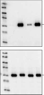 Western blot analysis of extracts from untreated or PDGF¬treated NIH/3T3 cells, pretreated with wortmannin and/ or rapamycin as indicated, using Phospho-Akt (Ser473) (193H12) Rabbit mAb (upper) or Akt Antibody  (lower).