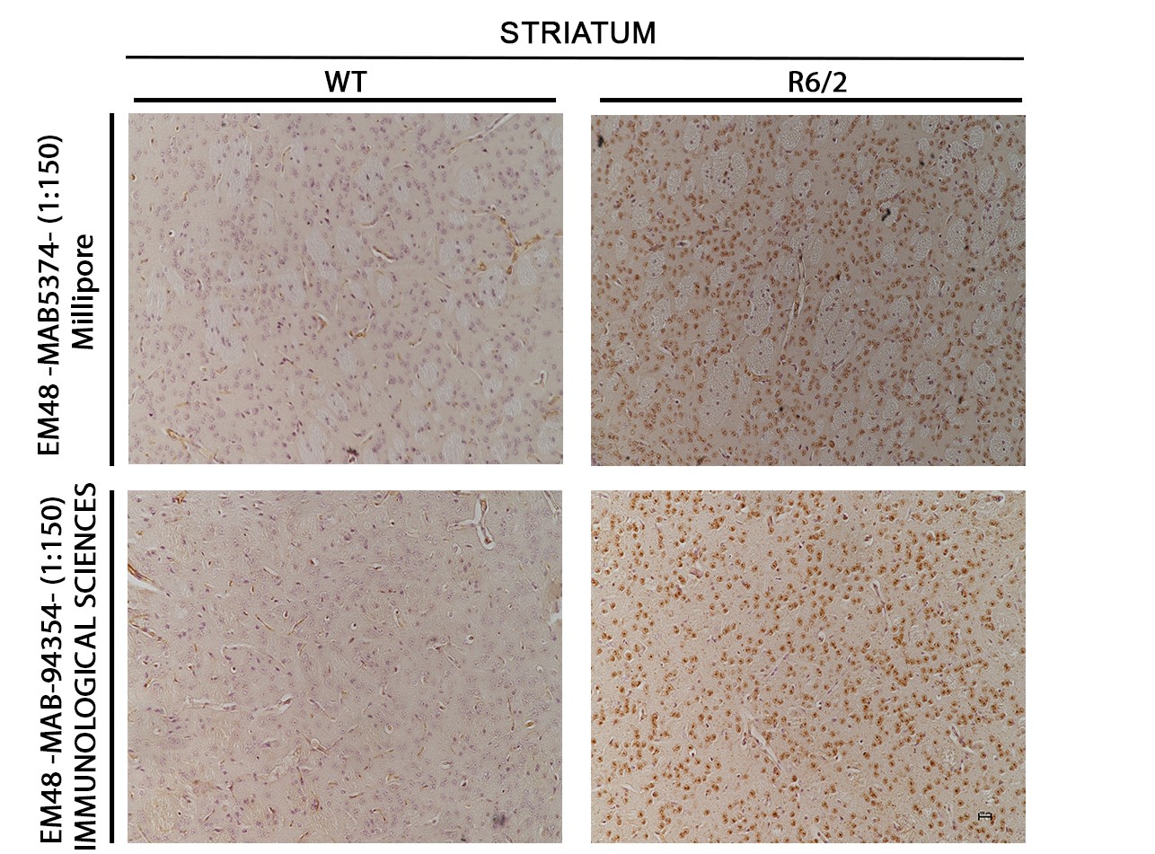 IHC on striatum of WT & R6/2 (transgenic mice affected Huntington) using MAB-5374 from Millipore and MAB-94354 from Immunological Sciences , for both antibodies the dilutions are : 1:150