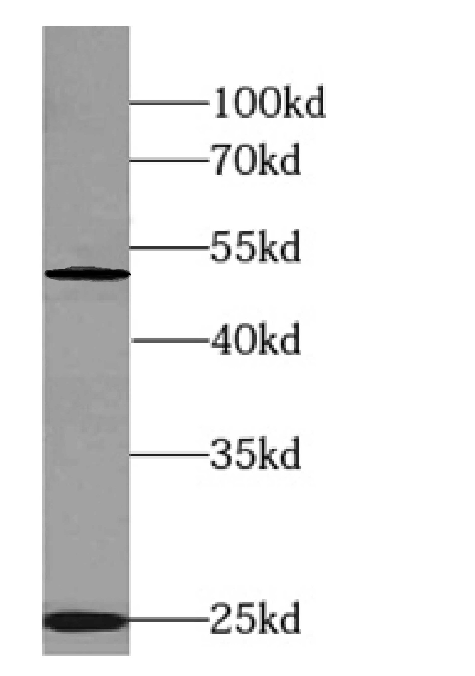 K-562 cells were subjected to SDS PAGE followed by western blot with ( phospho(403/404)-TDP43 Antibody at dilution of 1:1500