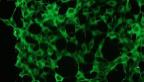 Immunofluorescence of  Erk1,2 expression
in  HEK293 cells, visualized  with  rabbit  anti-Erk1,2
Monoclonal Primary antibody dilution -1:100.