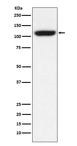 Figure 1. Western blot analysis of TRPM8 using anti-TRPM8
Antibody Electrophoresis was performed on a 5-20% SDS-PAGE gel at 70V (Stacking gel) / 90V (Resolving gel) for 2-3 hours. The sample well of each lane was loaded with 50ug of sample under reducing conditions.
After Electrophoresis, proteins were transferred to a
Nitrocellulose membrane at 150mA for 50-90 minutes. Blocked the membrane with 5% Non-fat Milk/ TBS for 1.5 hour at RT.
The membrane was incubated with rabbit anti-TRPM8 antigen affinity purified polyclonal antibody at 0.5 ug/mL overnight at 4°C, then washed with TBS-0.1%Tween 3
times with 5 minutes each and probed with a goat anti-Rabbit
IgG IgG-HRP secondary antibody at a dilution of 1:10000 for 1.5 hour at RT. The signal is developed using an Enhanced
Chemiluminescent detection (ECL) kit with Tanon 5200 system. A specific band was detected for TRPM8.