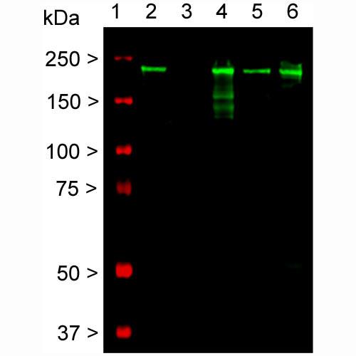 Western blot detection of the heavily phosphorylated axonal form of NFH
protein (pNF-H) in neural tissue lysates (20μg/lane) with affinity
purified mouse monoclonal anti-pNF-H antibody (AH1) at dilution of
1:5,000. Lanes on the blot are: [1] Protein size marker, [2] Adult rat
whole brain [3] Embryonic (E20) rat whole brain.  Adult rat spinal cord
 Adult mouse whole brain.   Adult mouse spinal cord. Rodent pNF-H
protein appears as a single band of about 200kDa in adult rat and
mouse lysates, but is not present in early development (Lane 3).
Additional bands appearing on the blot (Lane 4) are most likely partially
degraded products of pNF-H protein.