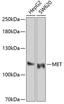 Western blot analysis of extracts of various cell lines, using MET Antibody  at 1:1000 dilution.
Secondary antibody: HRP Goat Anti-Mouse IgG (H+L) at 1:10000 dilution.
Lysates/proteins: 25ug per lane.
Blocking buffer: 3% nonfat dry milk in TBST.
Detection: ECL Enhanced Kit.
Exposure time: 30s.
