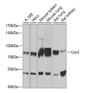 tfistern blot analysis of extracts of various cell
lines, using Cox2 antibody at 1:1000 dilution.
Secondary antibody: HRP Goat Anti-Rabbit IgG
(H+L) at 1:10000 dilution. Lysates/proteins:
25ug per lane. Blocking buffer: 3% nonfat dry milk
in TBST.
Detection: ECL West Pico Plus.
Exposure time: 3s.