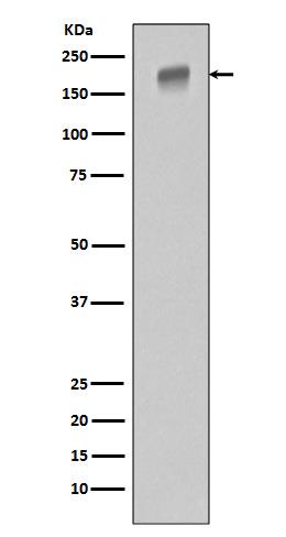 Western blot analysis of extracts of OVCAR3 cells, using EGFR Rabbit pAb at 1:1000 dilution.
Secondary antibody: HRP Goat Anti-Rabbit IgG (H+L) at 1:10000 dilution.
Lysates/proteins: 25ug per lane.
Blocking buffer: 3% nonfat dry milk in TBST.
Detection: ECL West Pico Plus.
Exposure time: 10s.