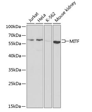 Western blot analysis of extracts of
various cell lines, using MITF antibody
at 1:1000 dilution. Secondary
antibody: HRP Goat Anti-Rabbit IgG (H
+L) at 1:10000 dilution.
Lysates/proteins: 25ug per lane.
Blocking buffer: 3% nonfat dry milk in
TBST.